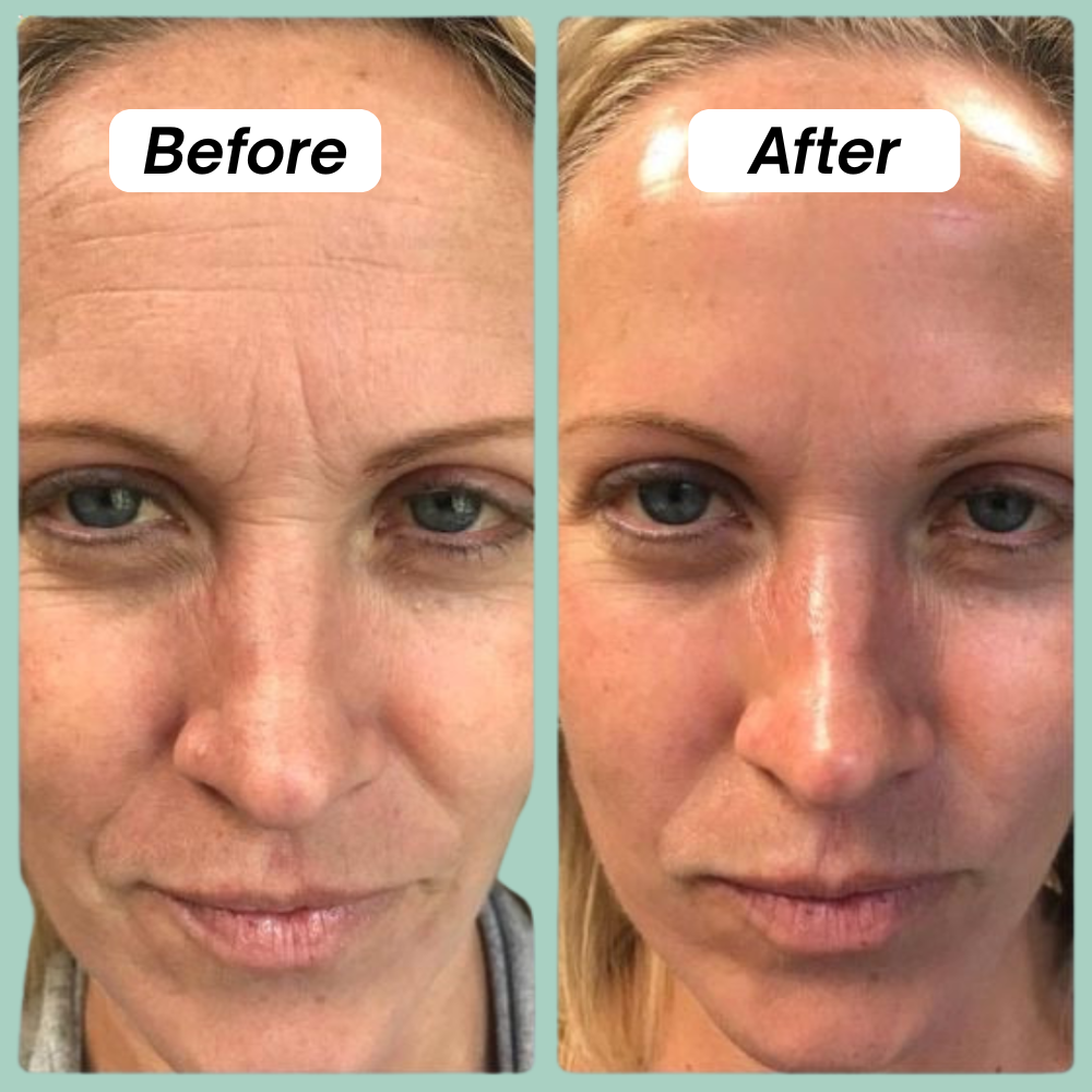 Bio-Collagen Mask – 37g of Low-Molecular Collagen